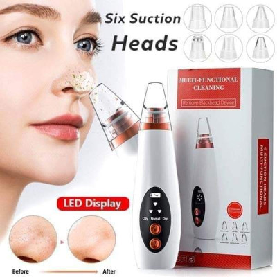 Blackheads Remover