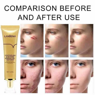 LANBENA Scar Remover Gel  Whitening Moisturizer Serum