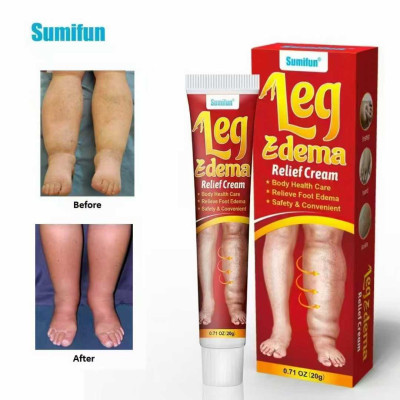 Sumifun Leg Edema Relief cream